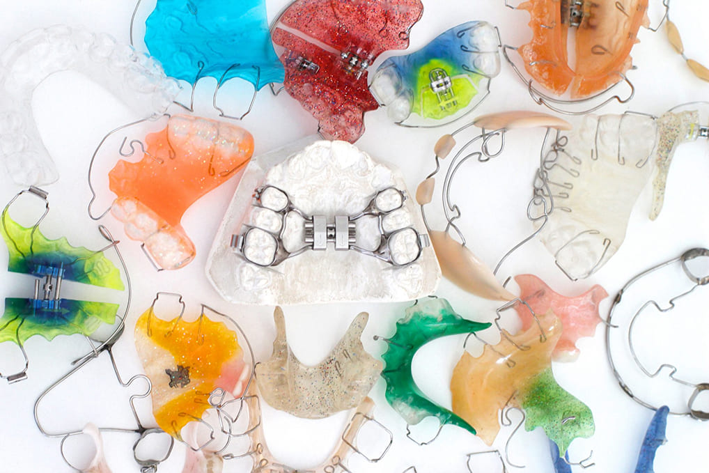 Ортодонтические аппараты